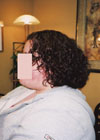 Client before