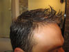 Partial after