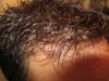 Client after