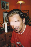 Younger man with partial