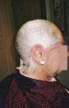 Making template (imprint) for her custom wig