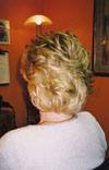 Partial after