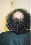 Client before