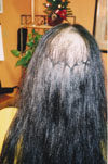 Client before; rear view with links