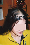 Client before; front view with links