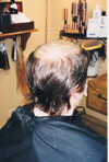 Client before; rear view
