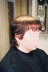 Client before; profile