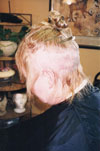 Client before; rear view